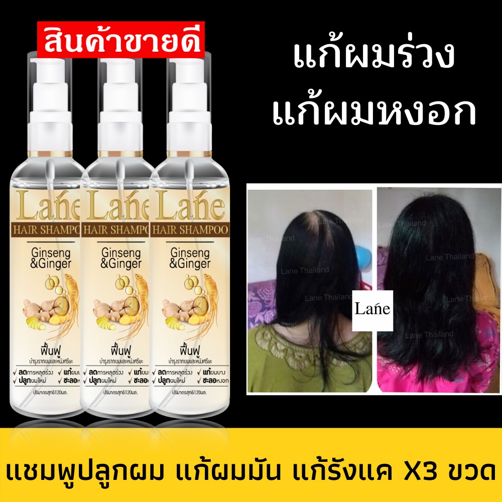 อัลบั้ม 101+ ภาพพื้นหลัง ยา สระ ผม แก้ คัน หัว ครบถ้วน