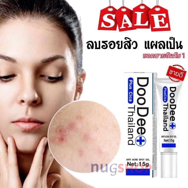 เจลลบรอยแผลเป็นทุกชนิด ลดสิว หลุมสิว ฝ้า กระ รอยดำ รอยแตกลาย ท้องลาย ขาลาย DooDee Thailand พร้อมส่ง