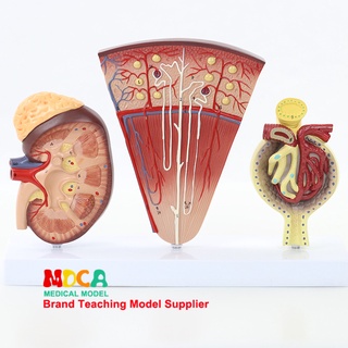 Human Anatomy Model Nephrons ของมนุษย์ไตขยายไตแบบจำลองทางกายวิภาคระบบทางเดินปัสสาวะการสอนทางการแพทย์ MSZ007 7QB1