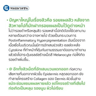 หมอมวลชน แอคซิน พีเอซี ครีม (Accin PAC) ครีมแต้มรอยแผลเป็นจากสิว