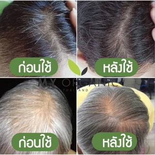 [โปรใหม่ ก.ค.] [ของแท้จากบริษัท] My Organic Hair M1 Hair Serum แฮเซรั่ม แก้ผมหงอก แก้ผมร่วง ผมบาง เซรั่มผม มายออร์