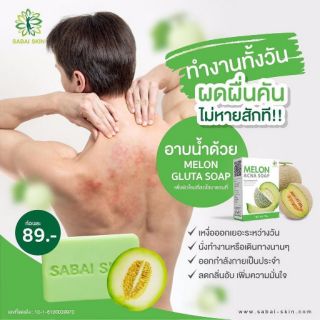 MELON ACNA SOAP สบู่เมล่อน เอคเน่ เชื้อรา ผดผื่นคัน แบคทีเรีย