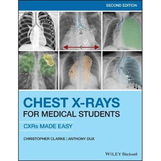 Chest X-Rays for Medical Students : CXRs Made Easy, 2ed - ISBN 9781119504153