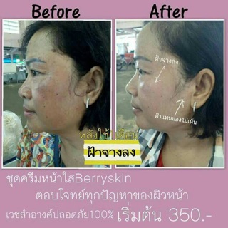 รีวิวครีม หน้าขาว หน้าเงา หน้าเด็ก