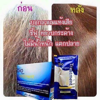 *แท้100%* ทรีทเม้นท์ซอง ไบโอ BIO น้ำเงิน ของแท้100% รับตรงจากโรงงาน ราคาส่ง ( จำกัดออเดอร์ละไม่เกิน 6 กล่องค่ะ )