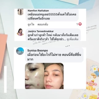 ครีมบำรุงผิวหน้า Winkface set