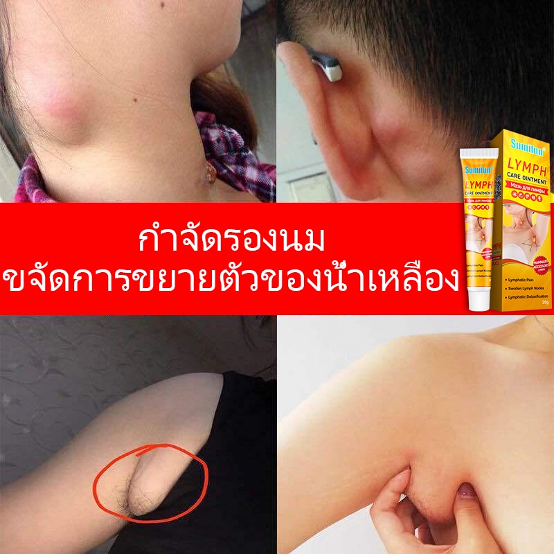 Sumifun ครีมระบายน้ำเหลือง ครีมน้ำเหลืองแบบอ่อนโยน ครีมบวมคอ ต่อมน้ำเหลืองบริเวณรักแร้