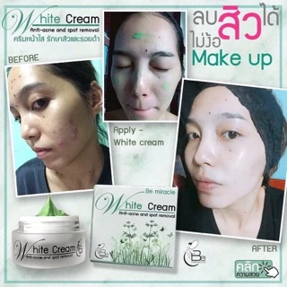 White Cream anti-acne ( บีมิราเคิลครีม) ครีมหน้าใส ครีมลดสิว•ขนาดทดลอง5กรัม•