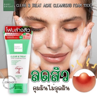 New! โฟมล้างหน้าลดสิว 【ผิวมัน เป็นสิวง่าย】 BABY BRIGHT CLEAR &amp; TREAT ACNE CLEANSING FOAM 120G.