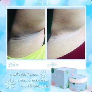 ครีมทารักแร้เพียวพร้อมส่ง