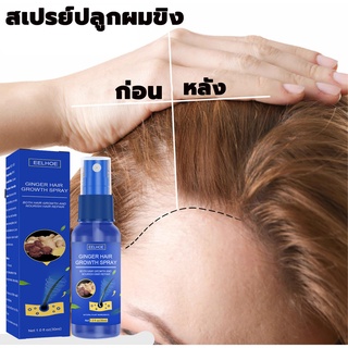 [ขายดีสุด]EELHOE สเปรย์ขิงปลูกผม 30ml สเปรย์ปลูกผม ยาปลูกผม,น้ำยาปลูกผม,เซรั่มปลูกผม,น้ำยาใส่ผม,น้ำมันปลูกผม Hair Growth