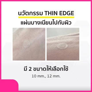 Curesys Niacin Acvita White Patch 18 dots แผ่นแปะสิว ดูดซับสิวพร้อมลดรอย ดูดเกลี้ยง แผ่นบาง เนียน ติดแน่น