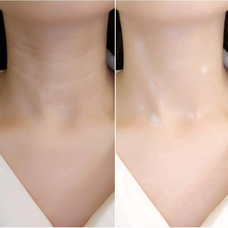 【สปอต】 1 ชิ้นให้ความชุ่มชื้นและให้ความชุ่มชื้นคอหน้ากากครีม 17g            【spot】1 Piece moisturizin