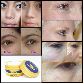 ครีม รอบ ดวงตา ครีม ลด ริ้ว รอย ใต้ ตา อายเจล 1 กระปุก 50 กรัม  Eye Gel Vera 50 g