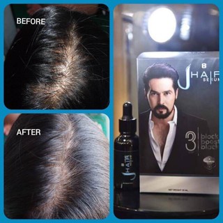 J hair serum 30ml ปลูกหนวด ปลูกเครา ปลูกจอน