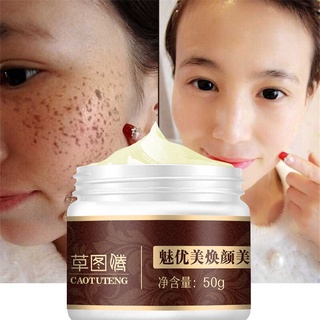 ครีมทาฝ้ากระ50g สลายจุดด่างดำที่แข็งแกร่งหลายชนิดWhitening Cream-9847