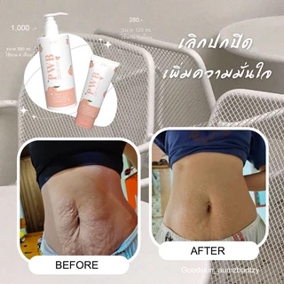 พร้อมส่ง ✨PWB ของแท้ 100%💕new packe💕ครีมบำรุงผิว ลดรอยแตกลาย รอยดำ รอยสิว รอยแผล มีบัตรตัวแทน