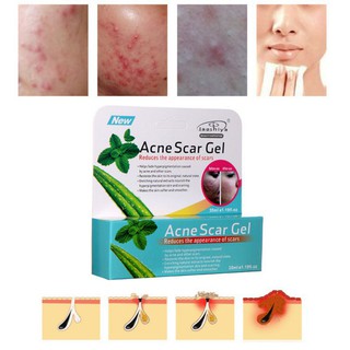 Aloe Vera Gel Face Moisturizer Anti Wrinkle Cream Acne Scar 35ml เจลว่านหางจระเข้สำหรับลดรอยแผลเป็น