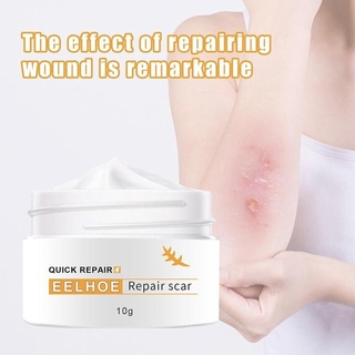 eelhoe scar removal cream