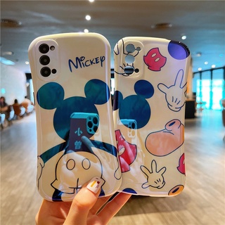 เคสโทรศัพท์มือถือ กันกระแทก ลายมิกกี้เมาส์ สําหรับ Vivo V23 V21 V20pro X50 X60 X70 X80 Y76 Y72 Y20s Y12s