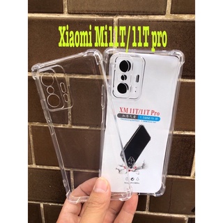 เคสใสกันกระแทกแบบคลุมกล้องรุ่นxiaomi11T /11Tpro