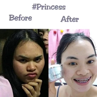 PRINCESS ครีมขมิ้นปริ้นเซส แท้ 100% [รับตรงจากแบรนด์ ] มากดใช้ส่วนลดหน้าไลฟ์ จัดหนักลดเยอะ