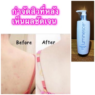 Luminesce Shower Gel สบู่เหลว ลดสิวที่หลัง ลูมิเนส ครีมอาบน้ำ เจลอาบน้ำ กำจัด สิว ที่หลัง