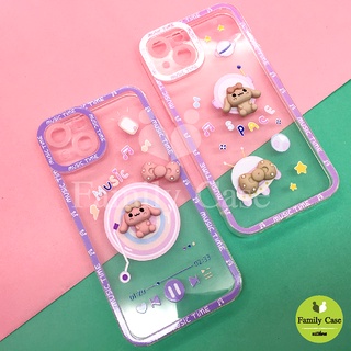 Oppo A31/A5s/A53/A93/A96 เคสมือถือนิ่มใสกันกล้อง ซิลิโคน TPU ติดการ์ตูนกระต่ายนูน