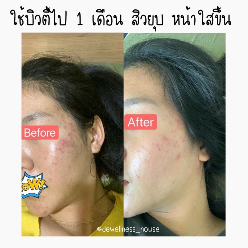 ร้านหมิวค่ะ ส่งด่วน น้ำค้าง [คลีนซิ่งโทนเนอร์-บิวตี้วอเตอร์-Beauty water-DEWellness  )