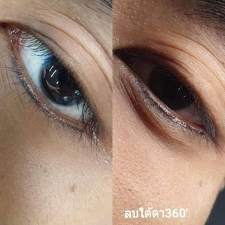 ผลิตภัณฑ์สำหรับลบรอยสัก ลบคิ้วปลิง คิ้วสองหาง