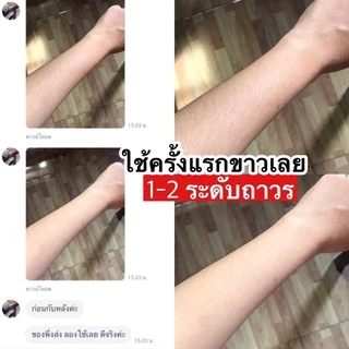 ⚡️4 แถม 1⚡️มาร์คผิว Valenwhite ‼️ของแท้ส่งจากบริษัท 100%‼️