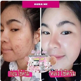 Aura me เพอร์เฟค อาบูติน ไนท์ครีม