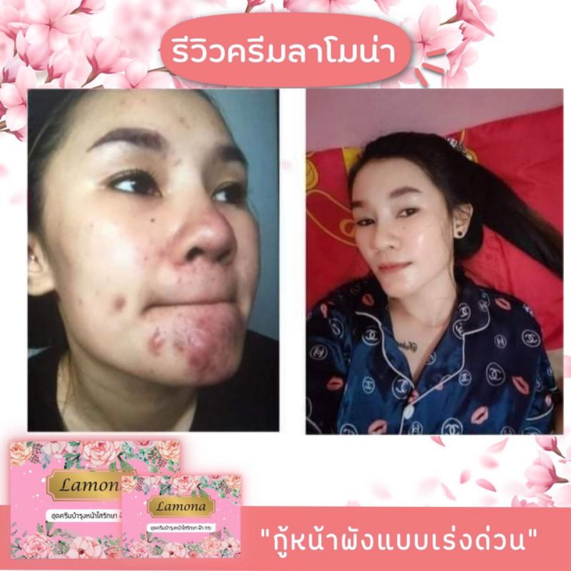 ครีมLamona (ลาโมน่า)ของแท้ (มีของแถม) tippawan_1805 ThaiPick