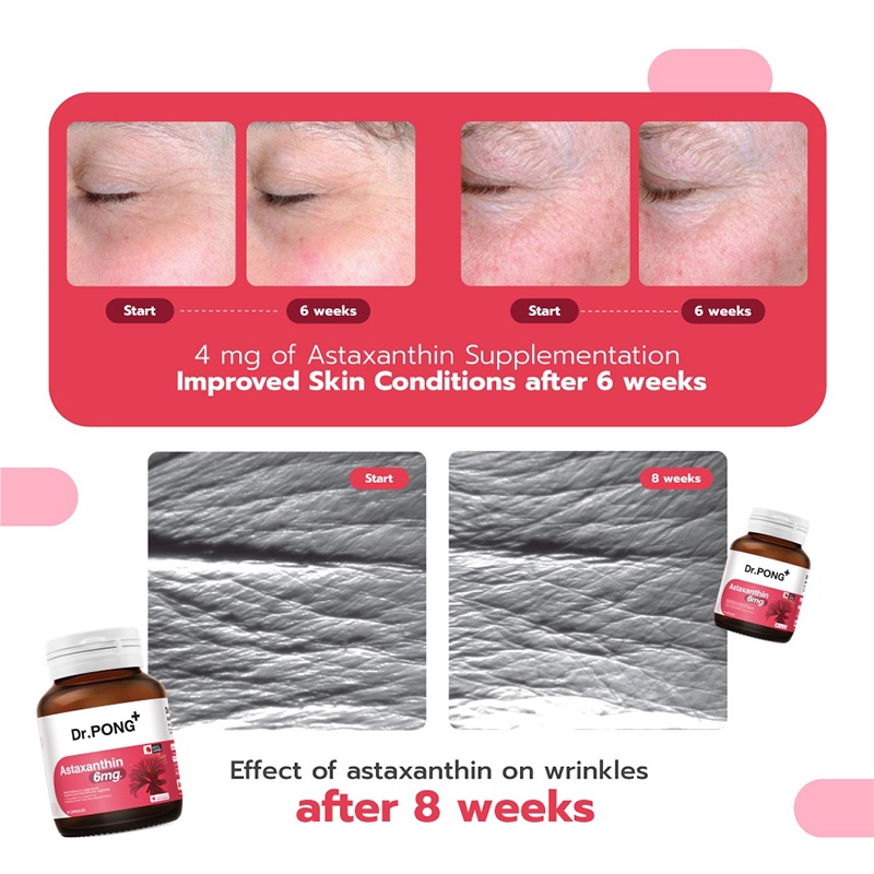Astaxanthin แอสต้าแซนติน บำรุงผิว ชะลอวัย ลดริ้วรอย กันแดด ลดการสร้าง
