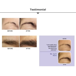 RapidBrow Eyebrow Enhancing Serum เซรั่มบำรุงขนคิ้ว ขนคิ้วดูดกดำและหนาขึ้น