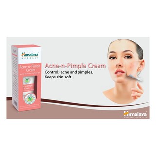 Acne-n-Pimple Cream 30gm