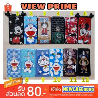 เคส wiko view prime / viewprime