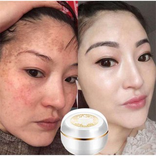 BIAOQUAN ครีมหน้าขาวใส ครีมบำรุงผิว ลดจุดด่างดำ ลดรอยสิว ฝ้ากระ หน้าเด็ก Whitening Face Cream Moisturizer Cream