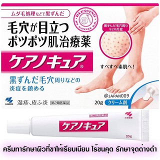 Kobayashi Keanocure 20 g. ครีมรักษาขาไม่เรียบ ขนคุด เม็ดจุดดำๆ ผดผื่นจากญี่ปุ่น