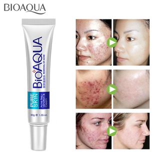 bioaqua cream for blackheads