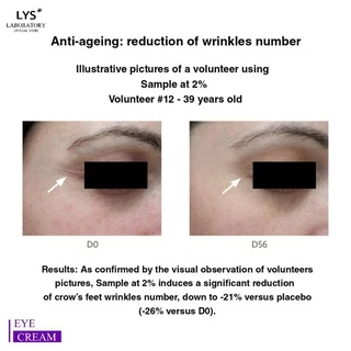 [🔥ราคาส่ง 3ชิ้น 255.-/ 5ชิ้น 215.-/ 10ชิ้น 195.-]LYS EYE CREAM ครีมรอบดวงตา กระชับ ริ้วรอย ใต้ตาคล้ำ 10 gm