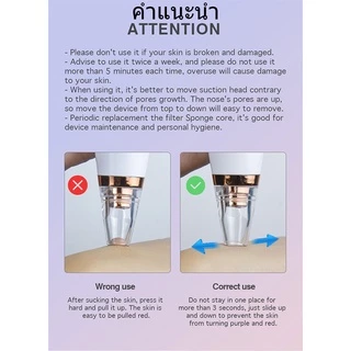 🔥 พร้อมส่ง 🔥เครื่องดูดสิว ที่ดูดสิวเสี้ยน สิวข้างจมูก ดูดสิวเสี้ยนอุดตันลบรอยจุดดำจากสิวเสี้ยนที่จมูก เครื่องดูดสิวไฟฟ้า
