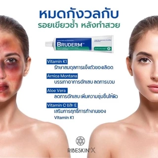 Bruderm ครีมลดรอยช้ำ ลดบวมอันดับ 1 exp.08/27