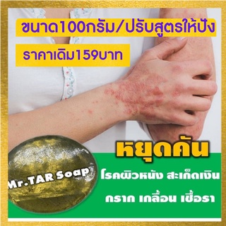 สบู่น้ำมันดิน MR.TAR Soap ขนาด100 กรัม โรคสะเก็ดเงิน เซบเดิร์ม ผิวหนังอักเสบ ผื่นคัน ผิวหนังอักเสบ ส่งด่วน