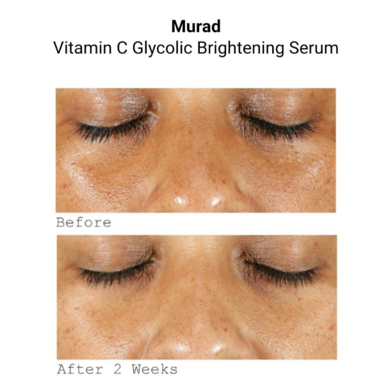 murad glycolic vitamin c serum