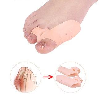 ซิลิโคนแยก hallux valgus แก้ไข