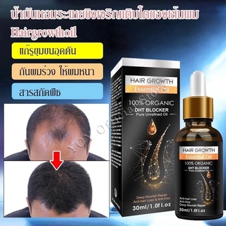 2 ชิ้น น้ำมันหอมระเหยขิงเจริญเติบโตของเส้นผม Hairgrowthoil