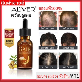 เซรั่มปลูกผม น้ำยาปลูกผม ยาปลูกผม ➤ของแท้100%