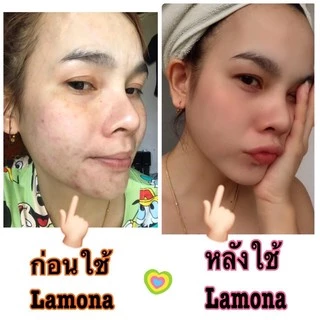 ครีม Lamona ของแท้💯%