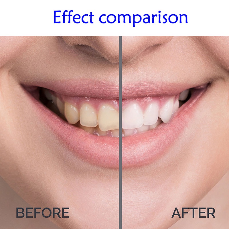 ช่องปากTeeth Whitening en Tooth Gel Cleaning Serum Remove laque Sta
